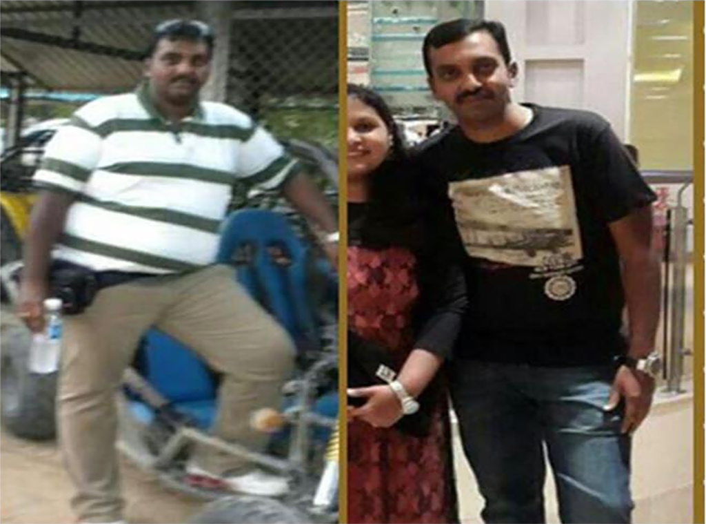 Pradeep went through a grate transformation for 100kgs to 80 kgs through bariatric surgery from dr tulip he shares his happiness with world now 