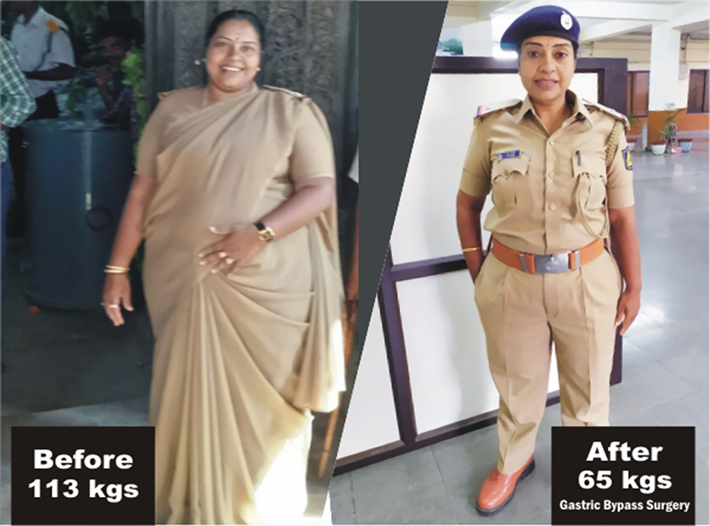 Vani is a police women startd to put on weight in her service but now she has found her self a new life after she went under bariatric surgery 